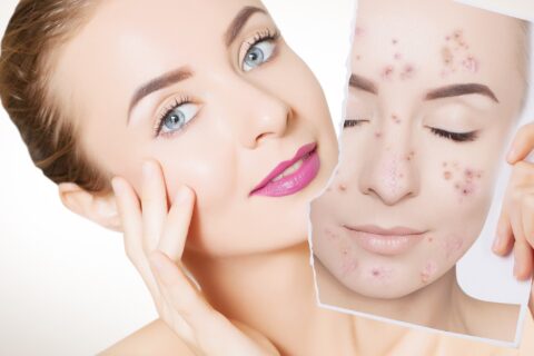 Skin Boosters in Bicester & Wantage