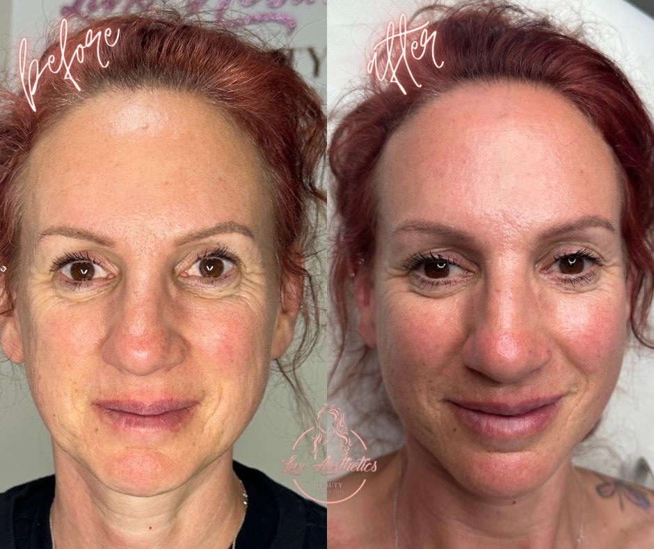 Non-Surgical Aesthetic Treatments Bicester & Wantage
