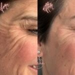 Secret Face & Body