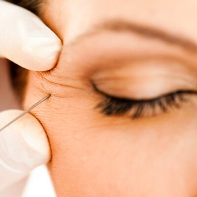 Licenced Bicester & Wantage Anti-Wrinkle Injections