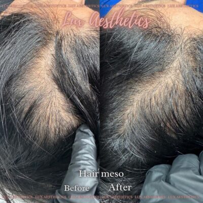 Hair growth treatment Bicester & Wantage