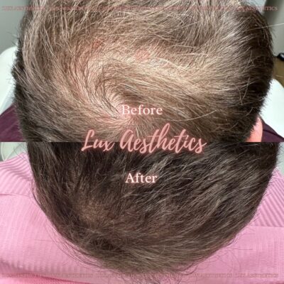 Hair treatment Bicester & Wantage